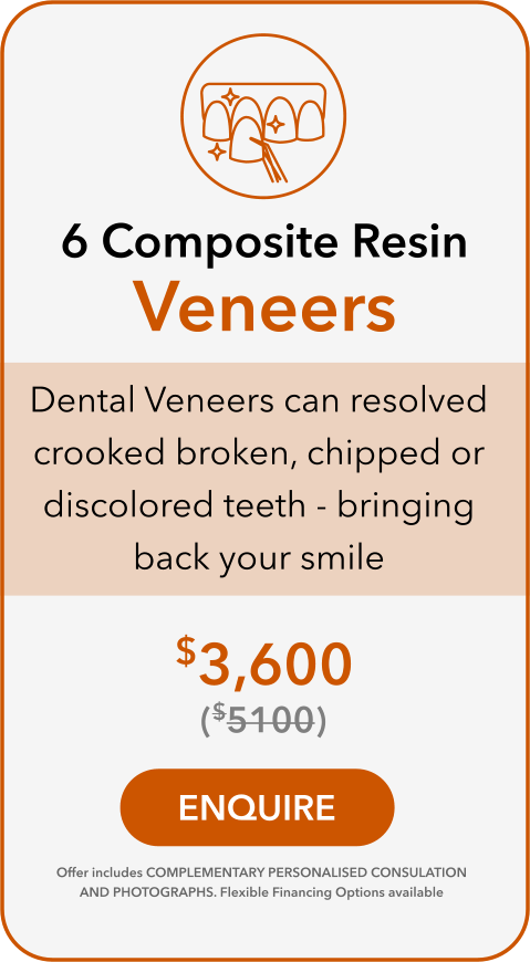 composite resin veneers