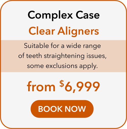 complex case clear aligners