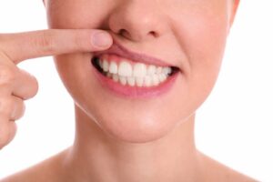 Early Gum Disease Signs