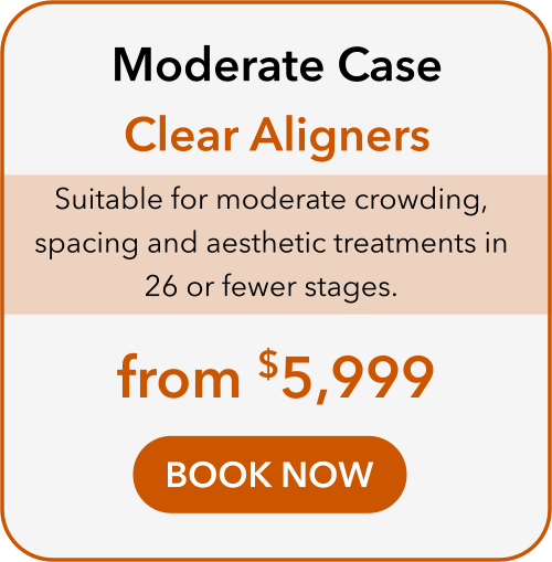 moderate case clear aligners