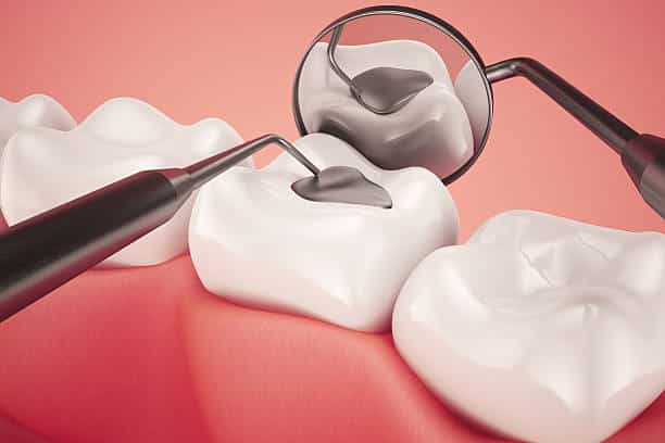 Post-Treatment Care