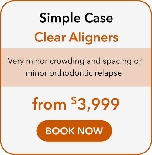 simple case clear aligner