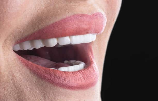 close-up of porcelain veneers model