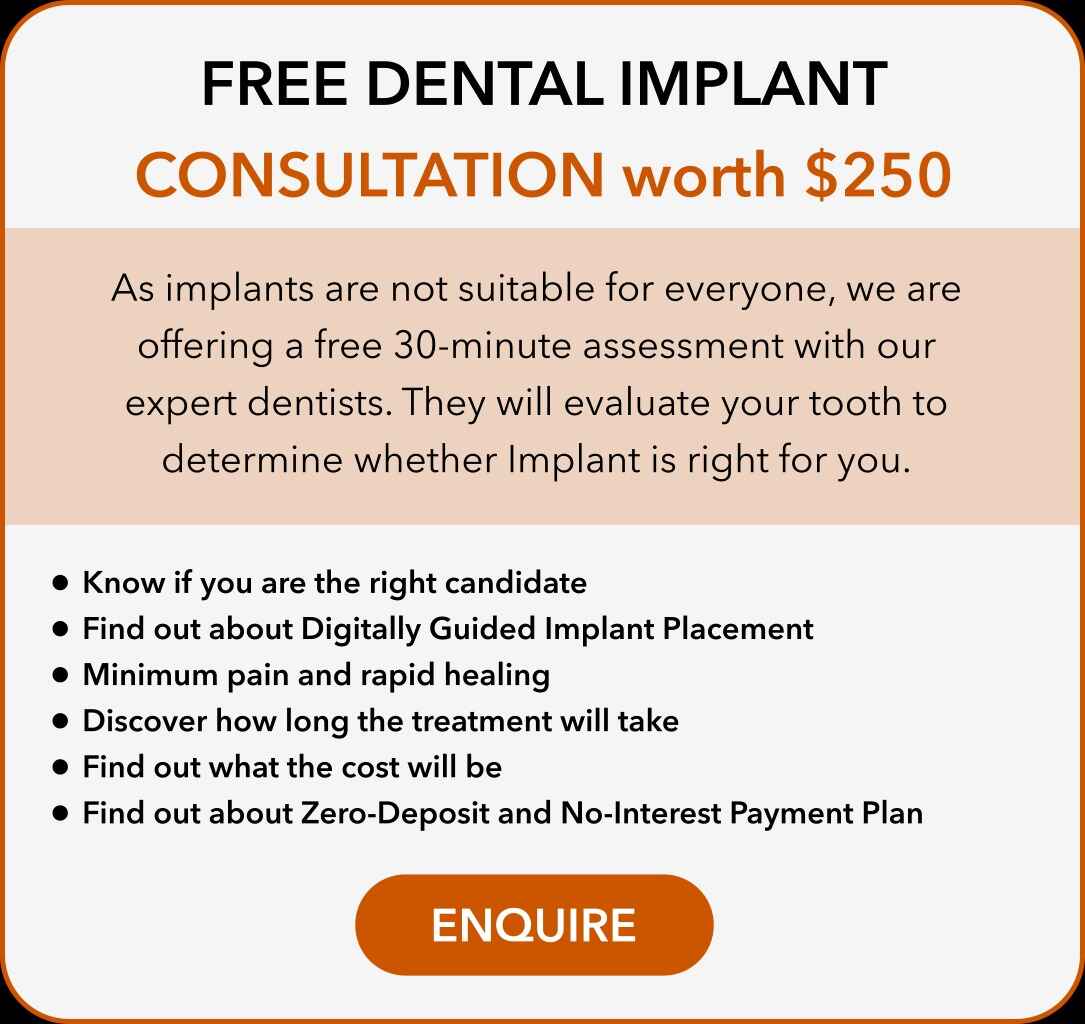 free dental implants consultation